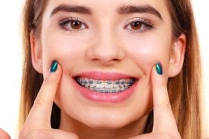 Orthodontist In Midtown