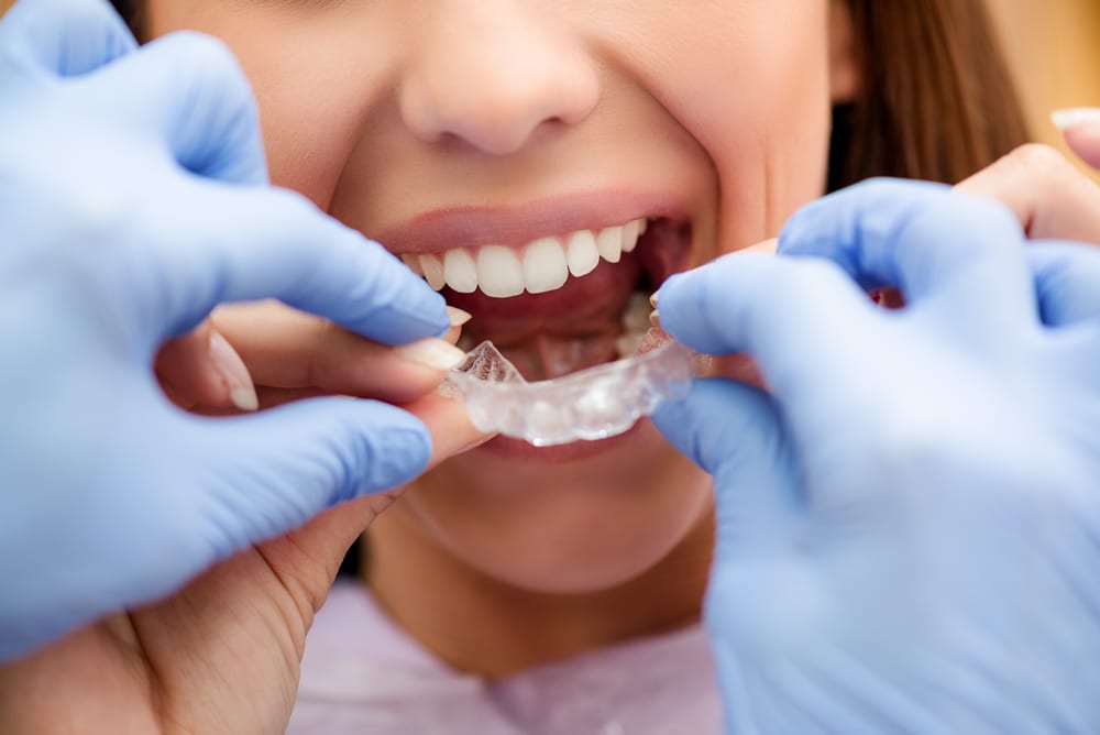 Orthodontic Arts lets you know if invisible braces hurt