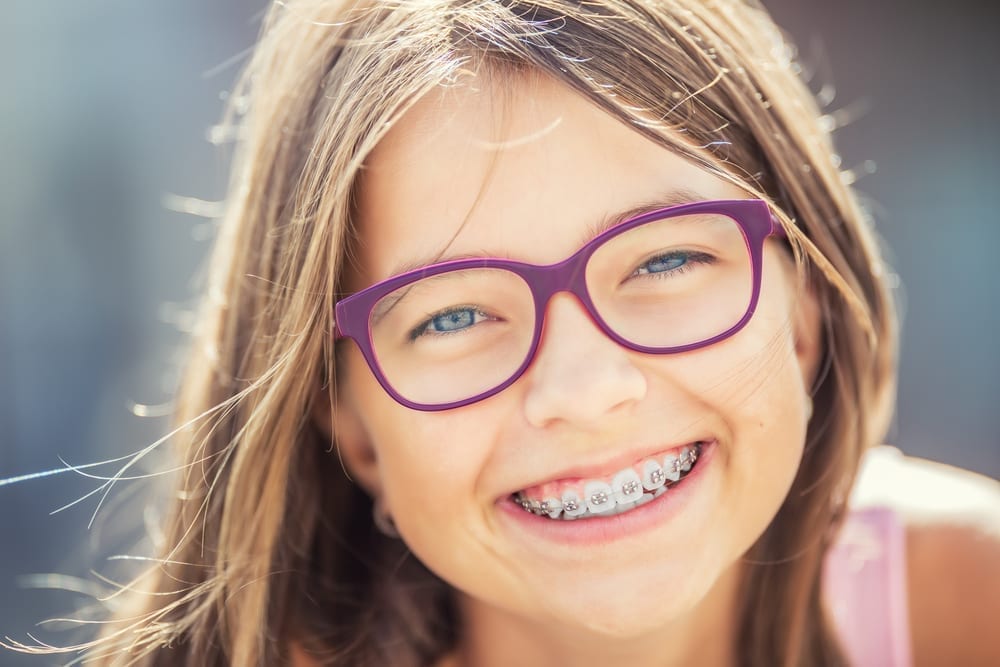 Orthodontic Arts shows you the major differences between regular braces and individual braces