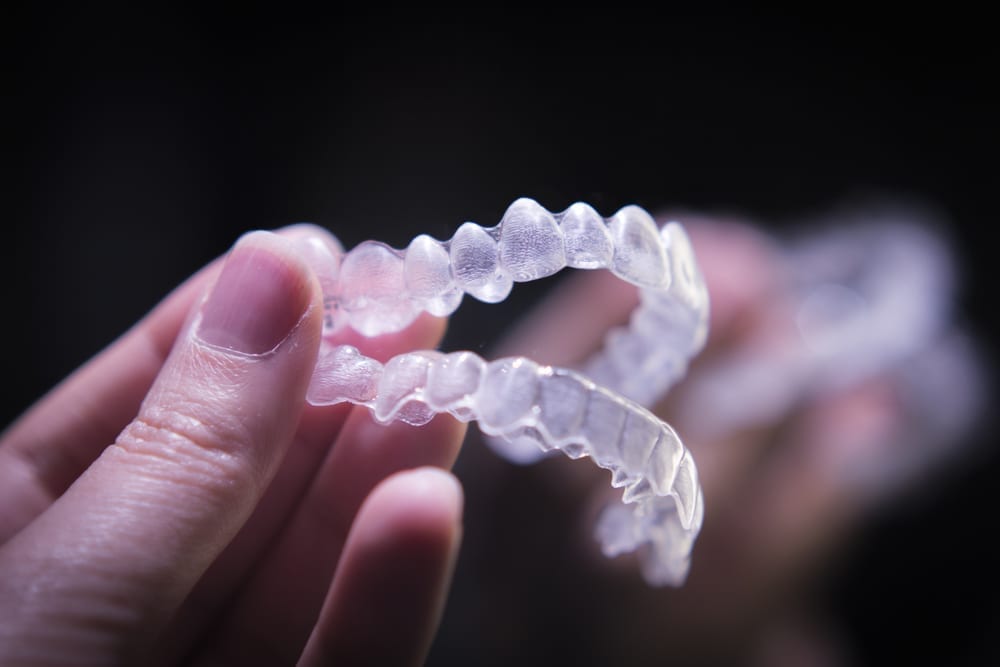 A photo of Invisalign from Orthodontic Arts.
