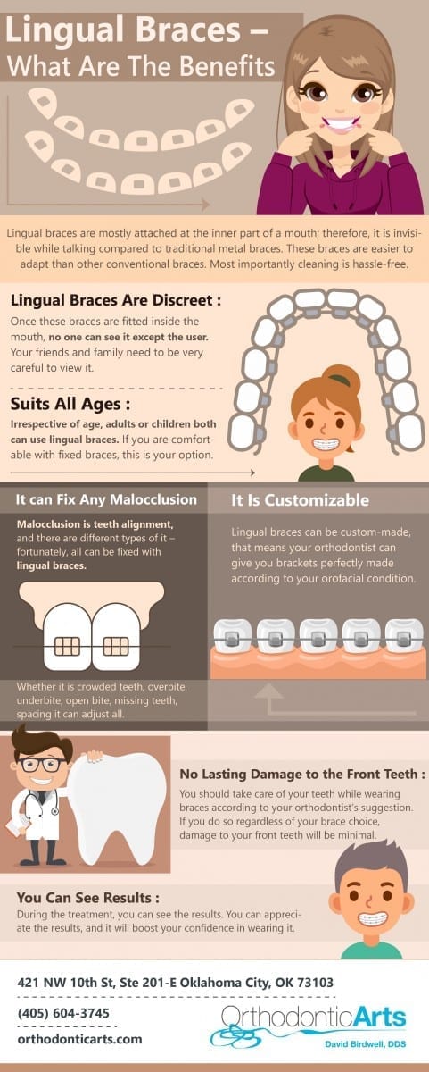 A photo of some of the benefits of Lingual Braces.