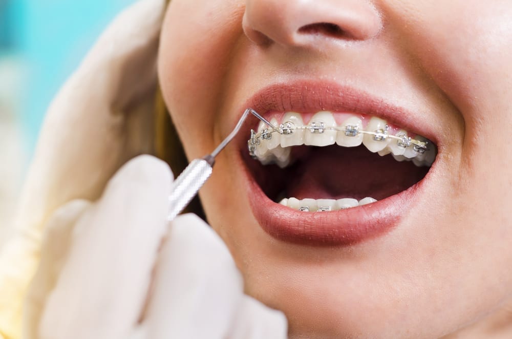 Orthodontic Arts OKC shows all about cosmetic dentistry.