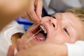 Photo of a patient at Orthodontic Arts learning how to floss with braces.