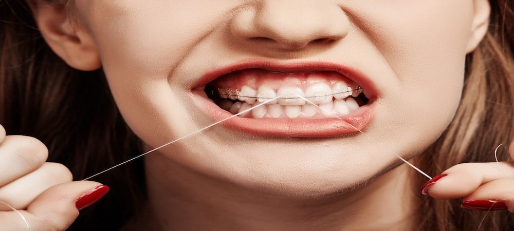 A photo of Orthodontic Arts showing you how to floss with braces.