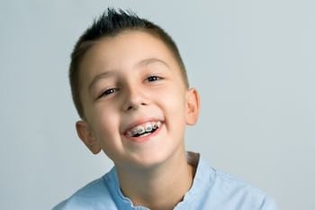 Orthodontic Arts shows you a photo of a patient going through phases of braces treatment. Orthodontic Arts shows you a photo of a patient going through phases of braces treatment.