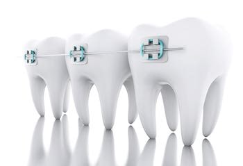 A photo of Orthodontic Arts telling you about the phases of braces.
