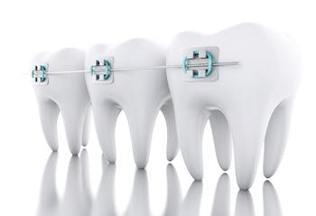 A photo of Orthodontic Arts telling you about the phases of braces. A photo of Orthodontic Arts telling you about the phases of braces.