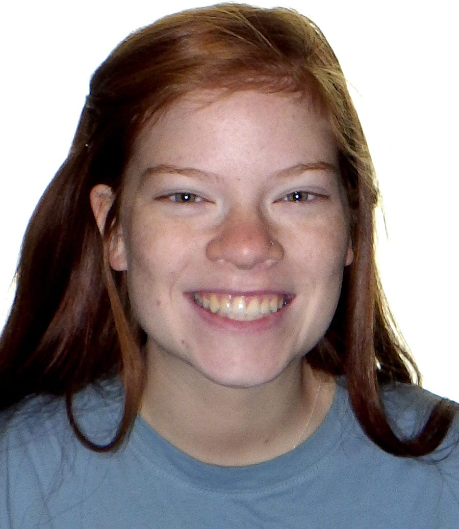 patient-1-after-smile