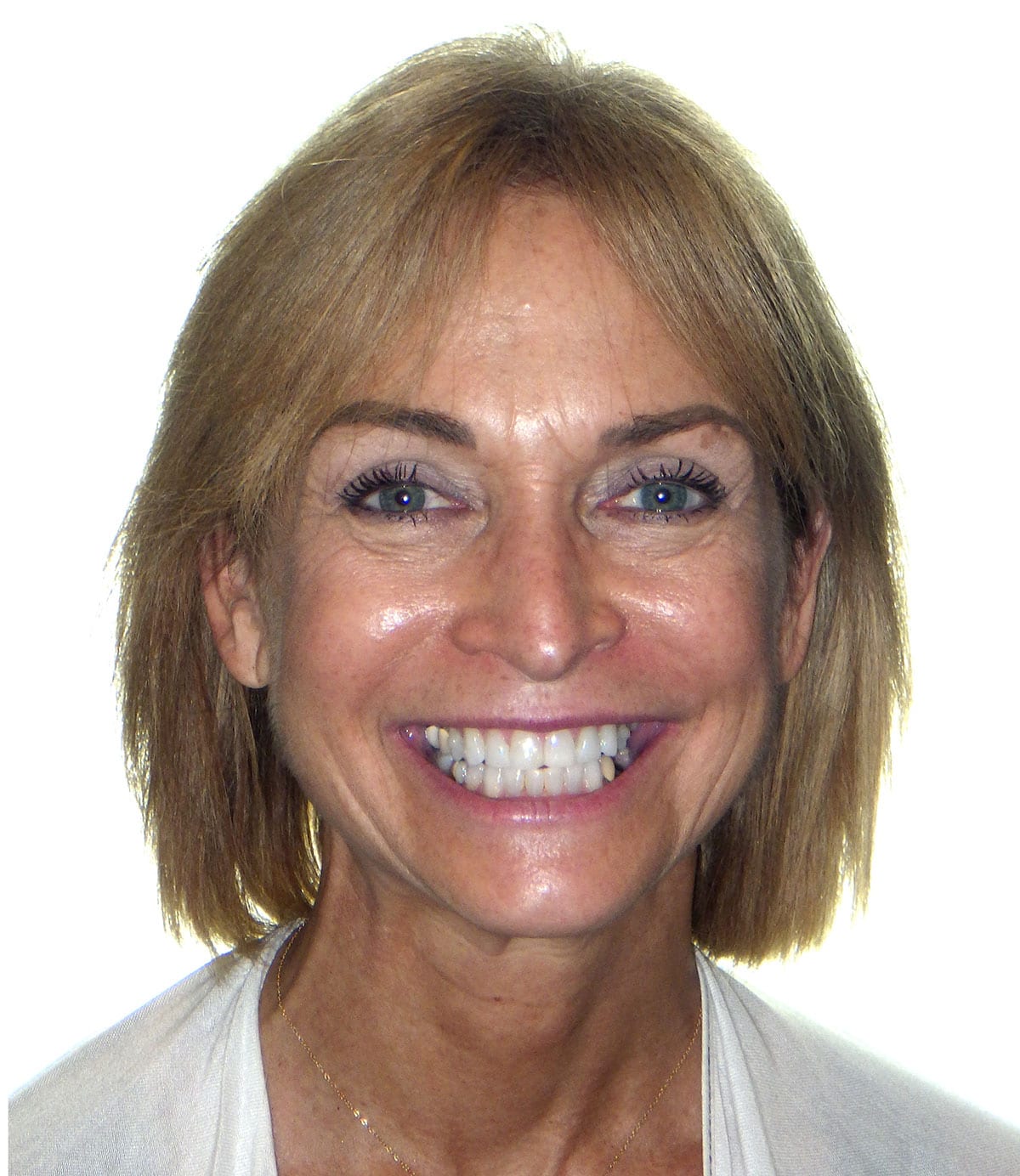 patient-2-progress-smile