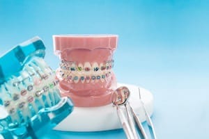 Orthodontic Arts shares interesting facts about orthodontists