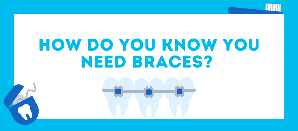 How do you know you need braces?