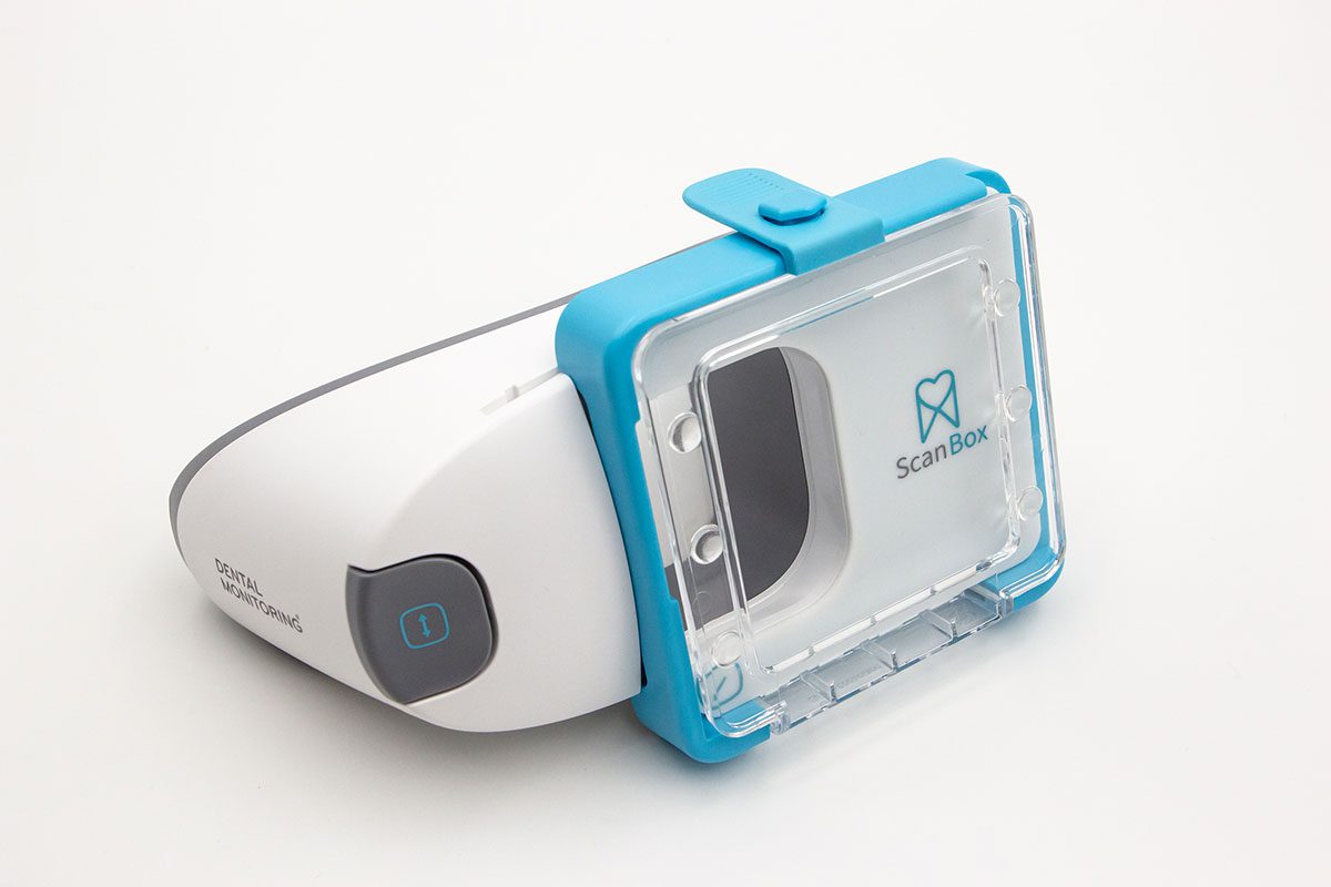 Image of a dental monitoring in OKC scan box