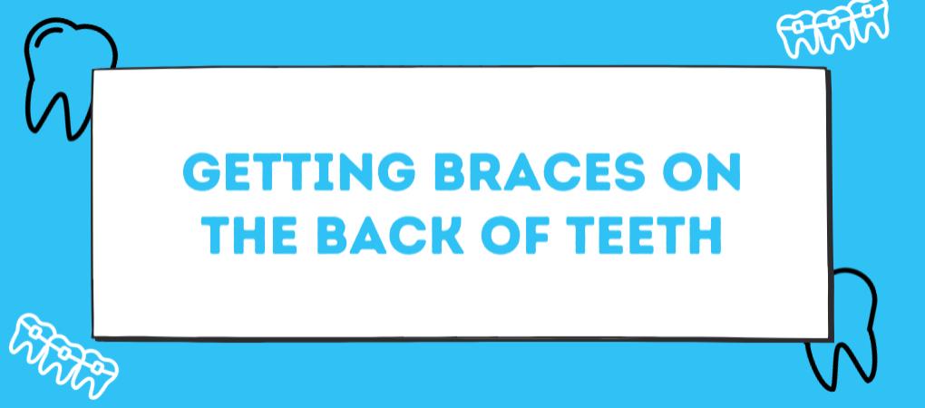 Braces On Back of Teeth Lingual Braces OKC