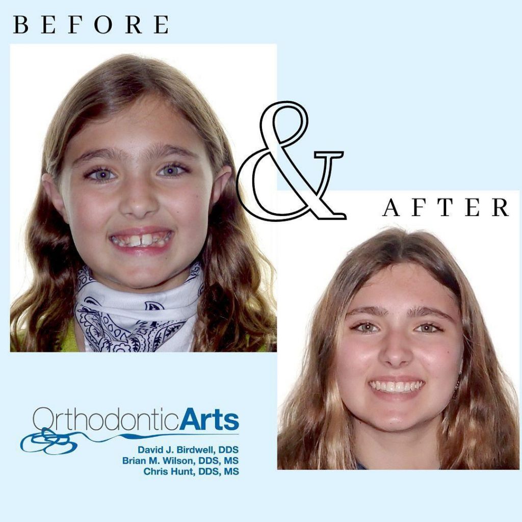 Kids Orthodontist Near Me